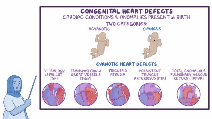 Nclex questions congenital heart defects